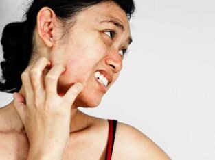 For Any Kinds of Facial Allergies, Feel Free To Contact Us!