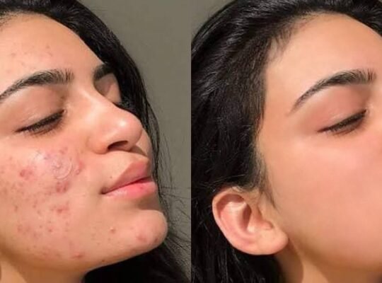 Photo retouching service