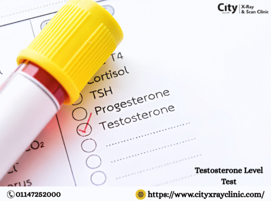 Affordable Testosterone Test Price in Delhi Today