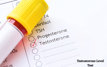 Testosterone Level Test Price Guide Check Cost Easily