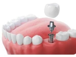 Dental Clinic near in Vashi