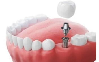 best dentist in Vashi