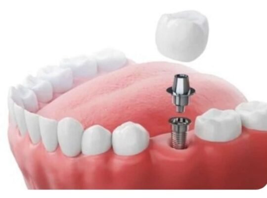 best dentist in Vashi