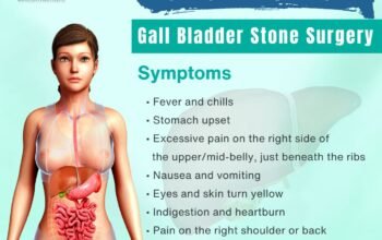 Who Performs Safe Gallbladder Removal Surgery in Yamunanagar?