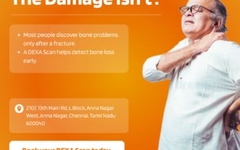 DEXA Scan Chennai | VO2 Max Test Chennai | Body Composition Analysis Chennai
