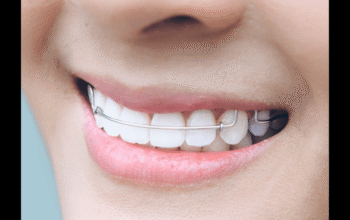 One Dentall – Clear Aligner Treatment
